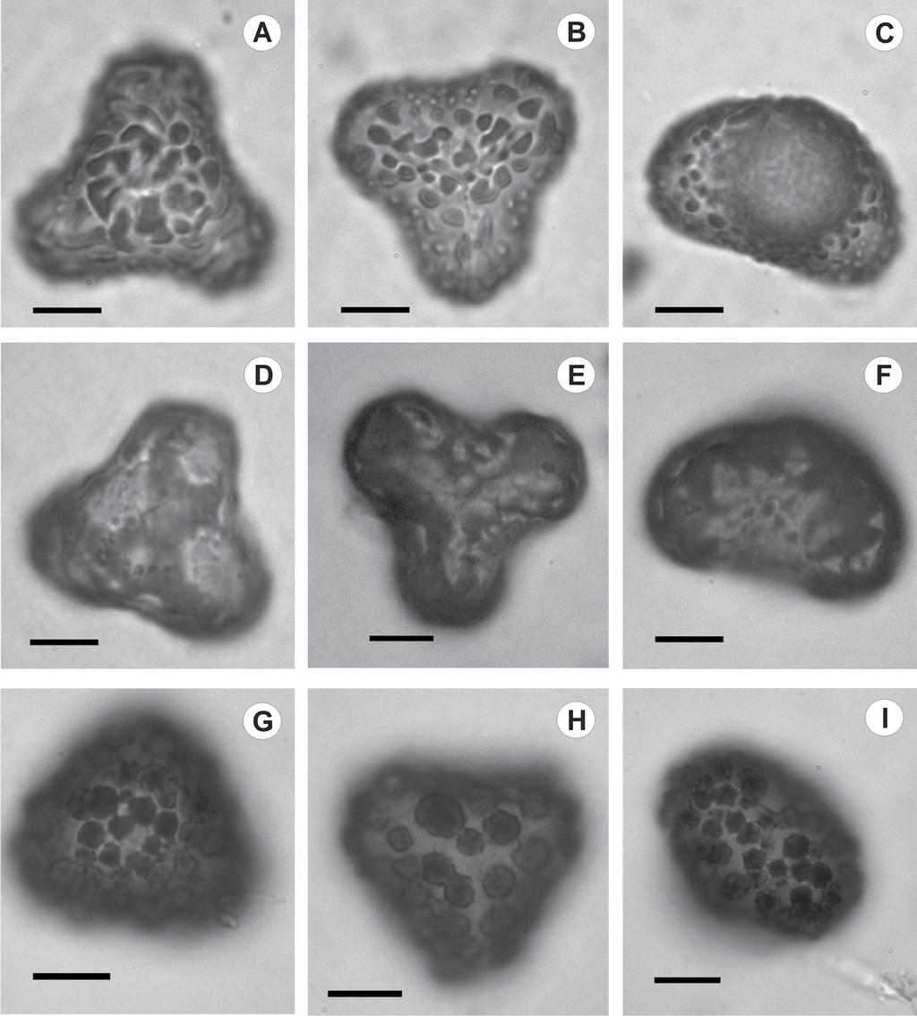 A. YAÑEZ ET AL. Dennstaedtia dissecta en Argentina Fig. 2. A-C, esporas de Dennstaedtia dissecta. A, en vista distal. B, proximal. C, ecuatorial. D-F, esporas de Dennstaedtia globulifera.