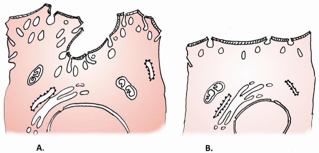 Actividad 7 Observe en preparados de vejiga urinaria su estructura histológica. Por qué se denomina epitelio polimorfo de transición al epitelio de revestimiento de este órgano?