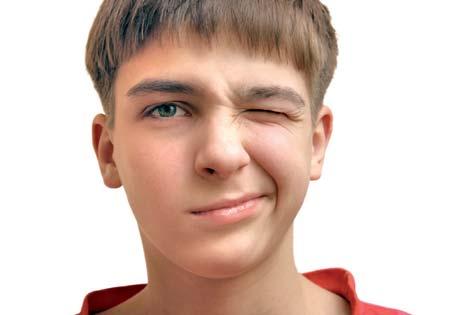 Tics en la infancia Pueden afectar a cualquier grupo muscular, aunque predominan los de la musculatura facial (ojos y boca fundamentalmente, tronco y extremidades). Los tics y el síndrome G.