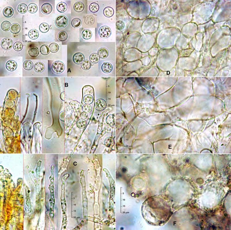 32 Revista Catalana de Micologia, vol. 32: 31-35; 2010. 230 µm crassus. Asci cylindracei, 162-212 9-11 µm, octosporati, operculati, tunica non amyloidea.
