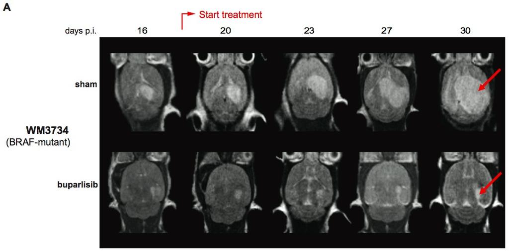 PI3K pathway inhibition achieves potent antitumor activity in melanoma brain metastases in vitro and in vivo 9 líneas celulares pre-establecidas (BRAF mut, NRAS, mut, pan-wt) 5