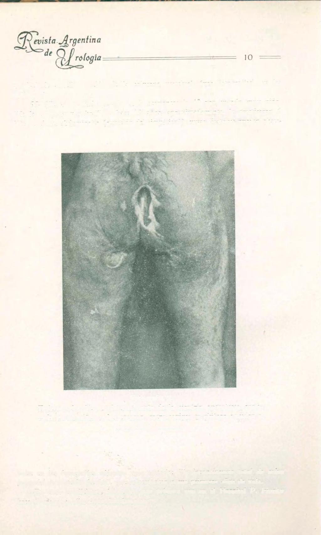 a nivel de aquella porción de la columna vertebral (ver fotografías), y las radiografías.