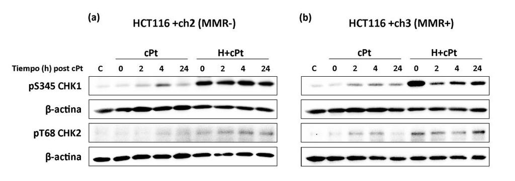 Capítulo 4 Resultados de recuperación, los niveles de ps345 CHK1 fueron menores que a tiempo 0, pero superiores a los observados en el grupo de células que recibieron sólo cpt.