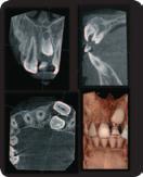 EL MISMO EQUIPO Programas 3D para planificación de tratamientos y diagnósticos precisos El X-MIND PANO 3D y el X-MIND 3Dx ofrecen a las clínicas dentales la oportunidad de realizar planificaciones de