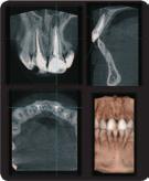 La imagen 3D aporta eficacia a la planificación de implantes y a las pequeñas cirugías generando mejor información de la estructura ósea, fracturas, dientes impactados, terceros molares, ATM y