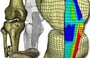 externas para amputados de piernas Análisis y diseño de dispositivos para diagnóstico y terapéutica de lesiones de