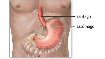 Estomago Gastritis y ulcera gástrica: Dolor urente