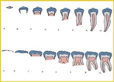 Imagen 3. Escala de puntuación de los estadios de desarrollo dental. Fuente: Demirjian y cols. 29. Escafoides. 30. Diáfisis distal del Radio (R). 31. Diáfisis distal del cúbito.