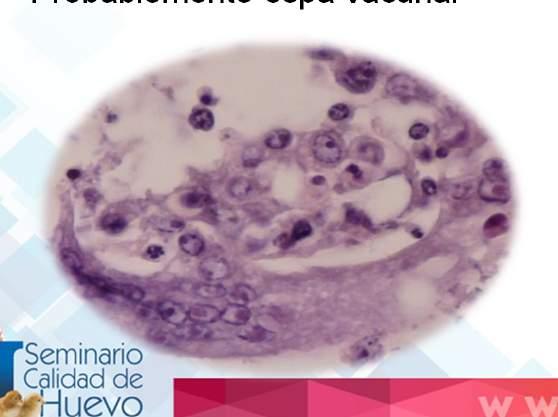 Histopatología 9 Semanas: Tráquea: Syncitia (inclusiones