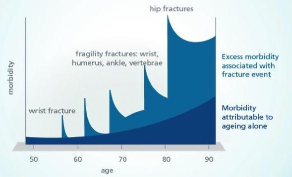 Osteoporosis Exceso de MORTALIDAD Fractura