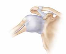 Pero, si hay alguna parte dañada, el movimiento del hombro puede volverse doloroso o difícil.
