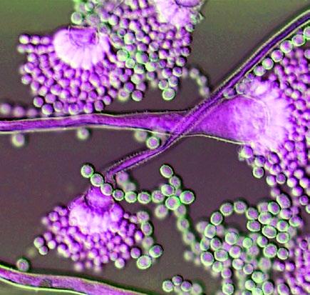 2017 Influencia de las micotoxinas en la inmunidad y la permeabilidad e integridad intestinal VERENA STARKL Gerente Técnico Micotoxinas en Biomin BOKU Universidad de Recursos Naturales y de Ciencias