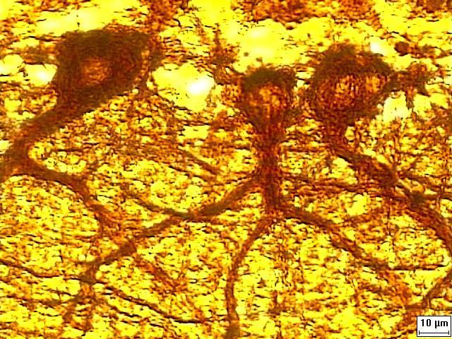 cereberal es consecuente a la migración superficial de neuroblastos.