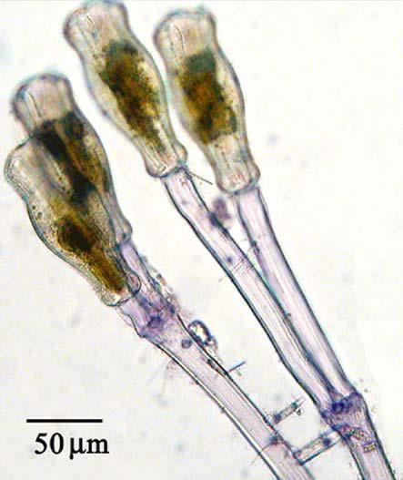 Didymosphenia geminata (Lyngb.