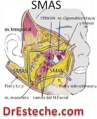SISTEMA MUSCULO APONEUROTICO SMAS Capa fribomuscular continua que envuelve la cara y el cuello. Está constituido por una fascia que conecta y distribuye la acción de la musculatura mímica facial.