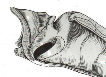 Cavidad laríngea Aditus laríngeo: Entrada a la cavidad. Vestíbulo laríngeo Pliegues vestibulares: Músc. ventricular + lig. vestibular. Ausente es bovino.