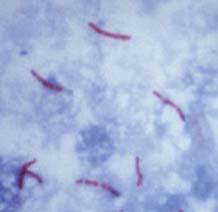 CARACTERÍSTICAS GENERALES del género Mycobacterium Bacilos delgados, rectos o ligeramente curvados, a veces ramificados, solos o en pequeños grupos. Mide 0.