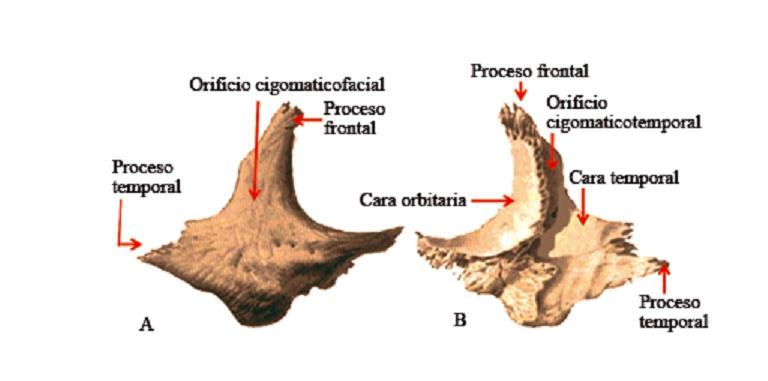Hueso maxilar superior Es un par de huesos cortos e irregulares. Aplanado de adentro afuera. Presenta dos caras interna y externa. Cuatro bordes y cuatro ángulos.