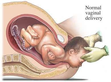 EL PART El fetus surt a l exterior per la vagina.