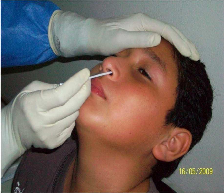 Obtención de muestra de Hisopado nasal Primero levante la