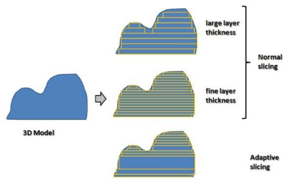 Órtesis impresa en 3D para el tratamiento de Pie Bot Los modelos son laminados utilizando una técnica denominada laminado adaptativo (o adaptive slicing), en la que se adapta la altura de capa en