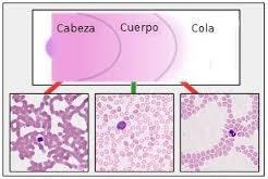 OBTENCIÓN DEL FROTIS DE SANGRE Cabeza: zona excesivamente gruesa. Se encuentra en la región inmediata al punto de partida de la extensión (en ella hay siempre un aumento del número de linfocitos).
