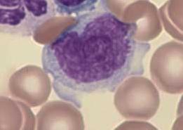 MORFOLOGÍA DE LOS ELEMENTOS Linfocitos: Es una célula generalmente pequeña (7 ), pero puede llegar hasta 12, encontrando pequeños, medianos y