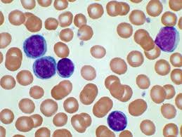 Citoplasma: Los más pequeños poseen escaso citoplasma color basófilo claro.