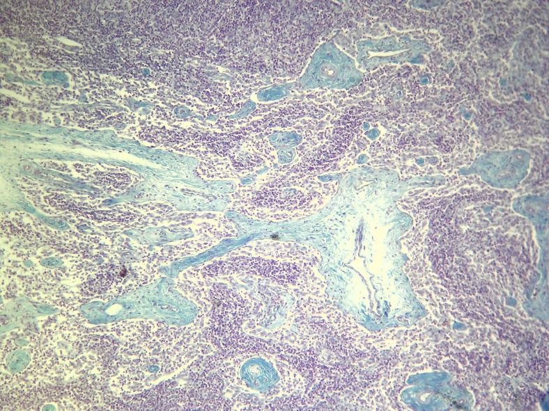 2- Indica qué zona del ganglio linfático se observa en la microfotografía.