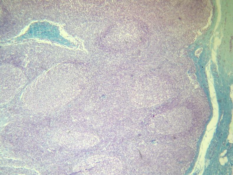 3- Indica qué zona del ganglio linfático se observa en la microfotografía.