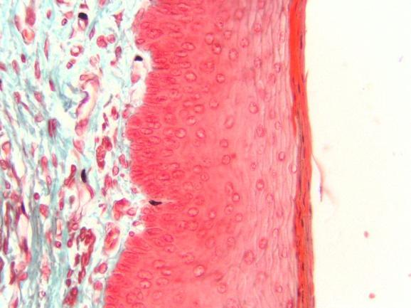 (epitelio estratificado plano con queratina); tráquea (epitelio seudoestratificado ciliado con células