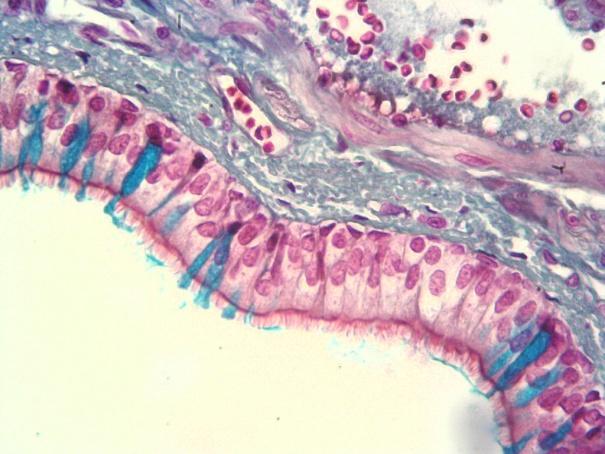 con queratina. Glándulas glomerulares (sudoríparas) y alveolares o saculares (sebáceas). Folículo piloso.