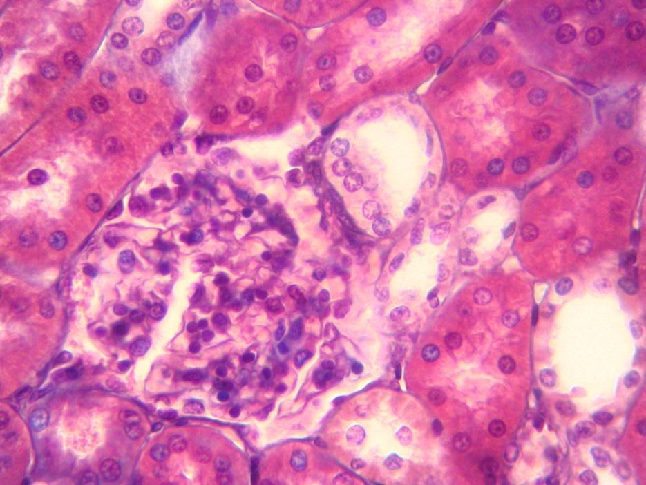 2- a- Indica a qué zona del parénquima renal corresponde la siguiente imagen microscópica. Justifica la respuesta.