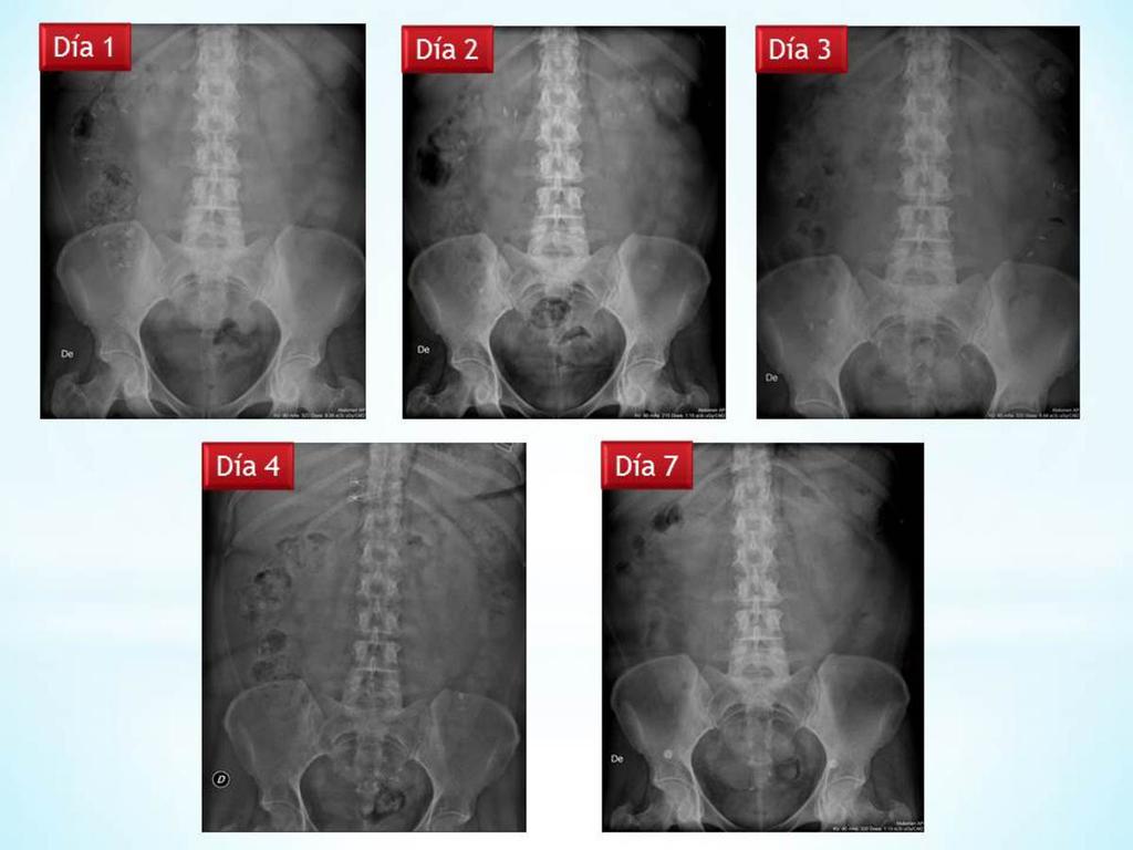 Fig. 8: Ejemplo de las radiografías de un