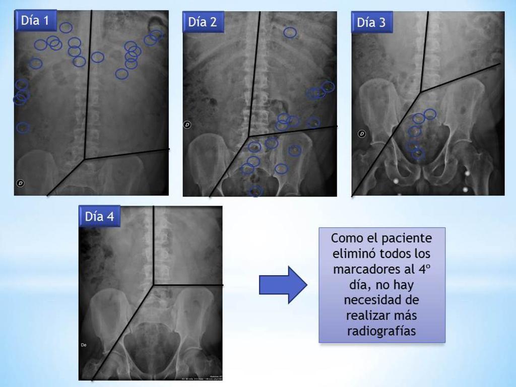 Fig. 5: Interpretación de las radiografías de