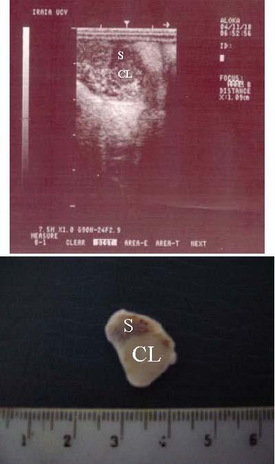 Evaluación de la ecografía transrectal para la detección 117 Figura 1. Imágenes: ecográfica (superior) y macroscópica (inferior) de un cuerpo lúteo (CL) y del estroma (S) ovárico ovino.