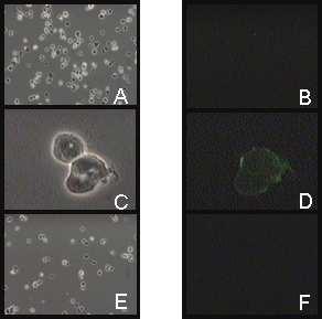 Contraste de fases Inmunofluorescencia Contraste de fases Inmunofluorescencia Figura 2. Reconocimiento de Antígenos de Superficie de. lamblia por los Anticuerpos Monoclonales enerados.