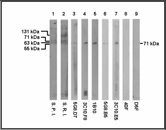 Figura 4. Reconocimiento Antigénico de los Anticuerpos Monoclonales Anti-. lamblia Mediante estern Blotting. Carril 1 suero obtenido de ratón infectado (S. P. I.