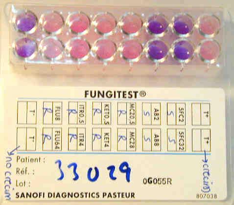 Fungitest Fundamento: Microdilución Colorimétrica Cada