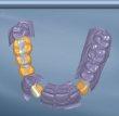 Dental Cad es claro y orientado al usuario.