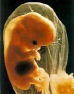 ABORTO ESPONATENEO 1. El 25% de los embarazos finalizan en abortos espontáneos. 2. La mayoría de ellos suceden en los tres primeros meses del embarazo. 3.