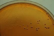 The SS agar is a very inhibitor that sometimes prevents the growth of certain species of Salmonella. We recommend using this medium unless accompanied by another inhibitor (HEA).