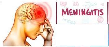 Tipo Viral La meningitis es la inflamación de las membranas que recubren el cerebro y la médula espinal, las meninges.
