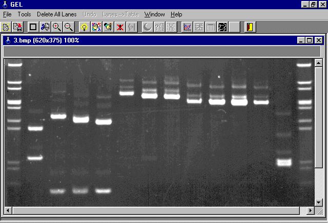 PCR Gel Image