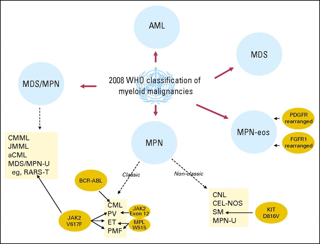 WHO myeloid neoplasm and acute leukemia classification Myeloproliferative neoplasms (MPN) Chronic myeloid leukemia (CML), BCR-ABL1 + Chronic neutrophilic leukemia (CNL) Polycythemia vera (PV) Primary
