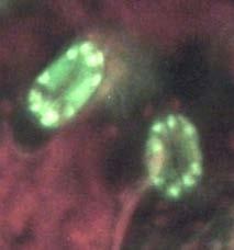 Observación de cloroplastos