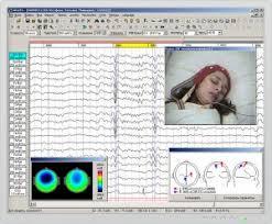 3. FISIOLOGÍA DEL SUEÑO Registro de señales EEG, EMG y EoG identificar vigilia y fases de sueño Varias secuencias/ciclos No REM-REM en