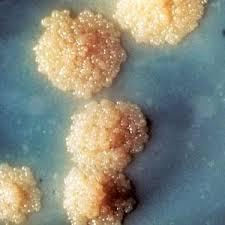 Debido a que posee antígenos compartidos por Mycobacterium tuberculosis, por el bacilo de la vacuna BCG y por micobacterias ambientales, disminuye su especificidad.