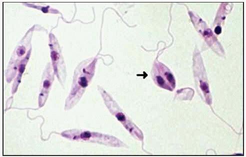 LEISHMANIASIS Es una zoonosis producida por un protozoo parásito del género Leishmania,