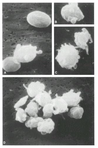 Agregación plaquetaria in vitro Método óptico (Born,